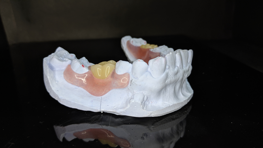 Prosthodontics nyc